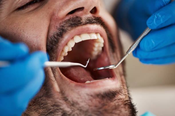 Best Teeth Whitening  in Eastwood, MI